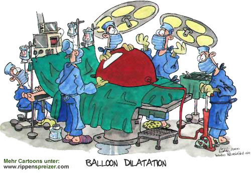 balloon dilatation