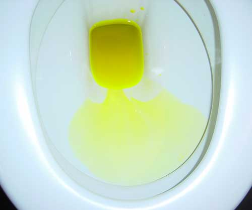 Fluoreszenzangiografie