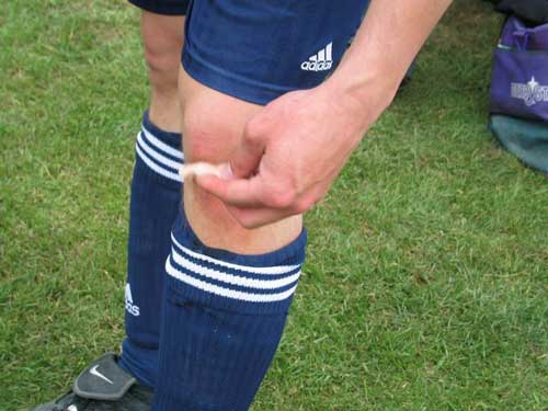 MediMeisterschaften 2003